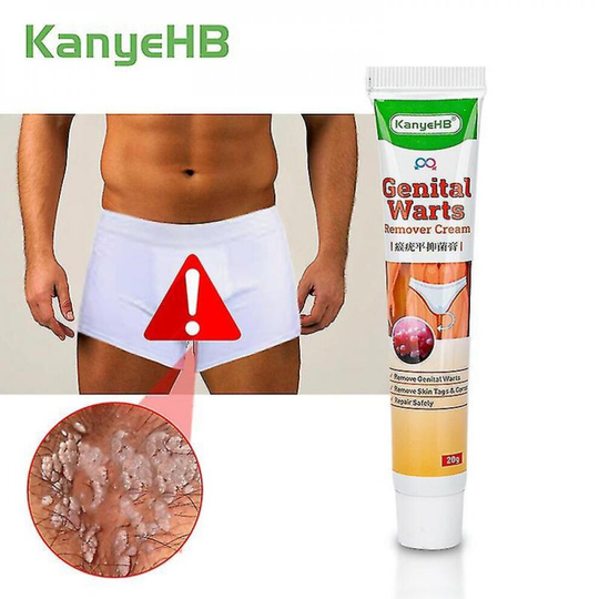 1pcs Skin Tag Remove Cream Genital Wart Fast Removal Warts Human Papillomavirus Mole Rapidly Removes Moles Foot Corn Cream G005