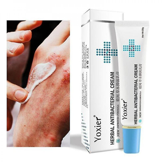 Tib Herbal Antibacterial Cream Psoriasis Cream Anti-itch Relief Eczema Skin Rash Urticaria Desquamation Treatment