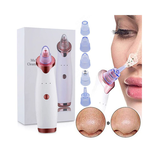 Electric Facial Blackhead Remover Acne Cleaner Blackhead Pore Vacuum