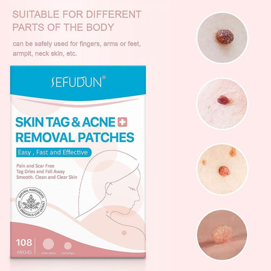 Sefudun Wart Removal Sticker Skin Tag Remover Flat Neck Wart Face Wart 108pc