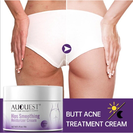 Butt Body Acne Whitening Cream Emulsions Acne Clearing Spot Treatment Lotion