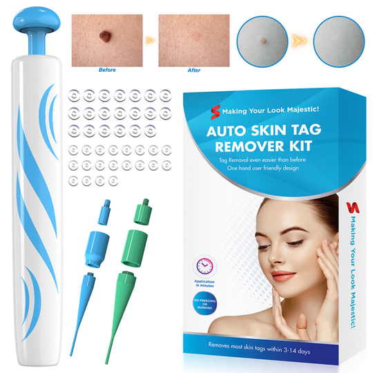Painless Micro Auto Skin Tag Mole Wart Removal Rubber Bands Kit Skin Cleansing