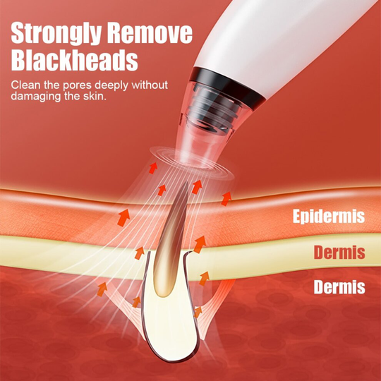 Electric Blackhead Remover Suction Cleaner Deep
