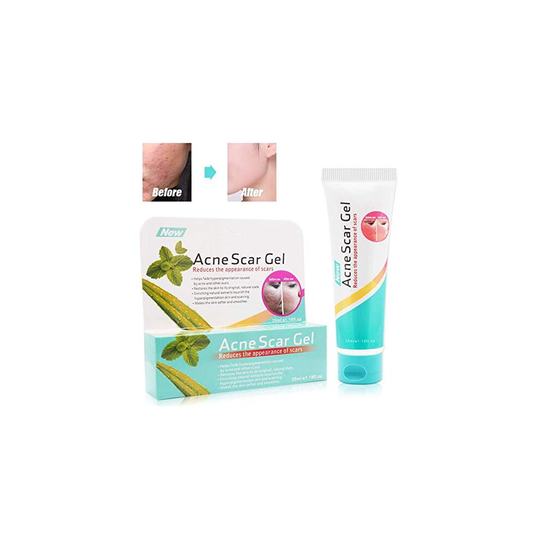 Scar Removal,Acne Scar Removal Gel,Treatment for Face,Lighten acne marks,moisturizes and brightens skin, balances oil secretion,Natural, Gentle &