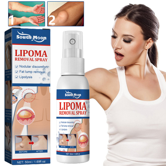 Lipoma Removal Spray Fat Knot Spray Relieving Body Fat Lump Tumor Subcutaneous 50ml