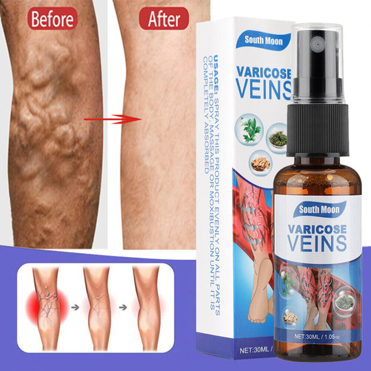 Varicose Veins Miracle Ointment Cream Gel Veinhealing Varicose Treatment Spray