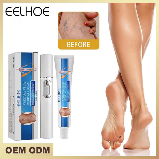 Eelhoe Vein Repair Cream De-stressing Veins Vein Massage Varicose Relief Cream Painful Bulging Leg Veins Cream 20ml Box + Laser Pointer