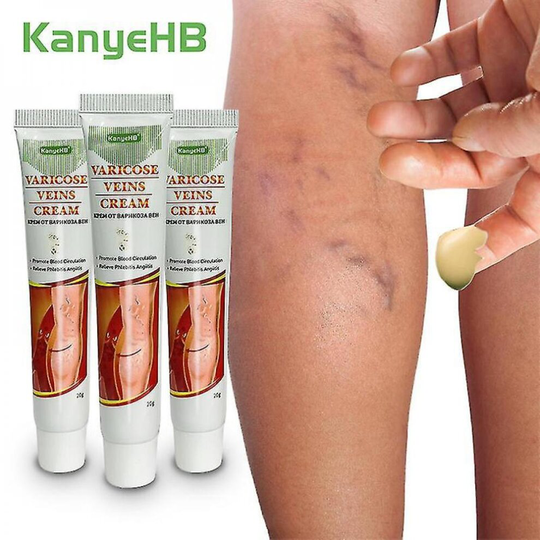 3pcs Varices Medical Cream Varices Treatment Cream Genital Varicocele Ointment Varicose Veins Plaster Varicosity Cream A641