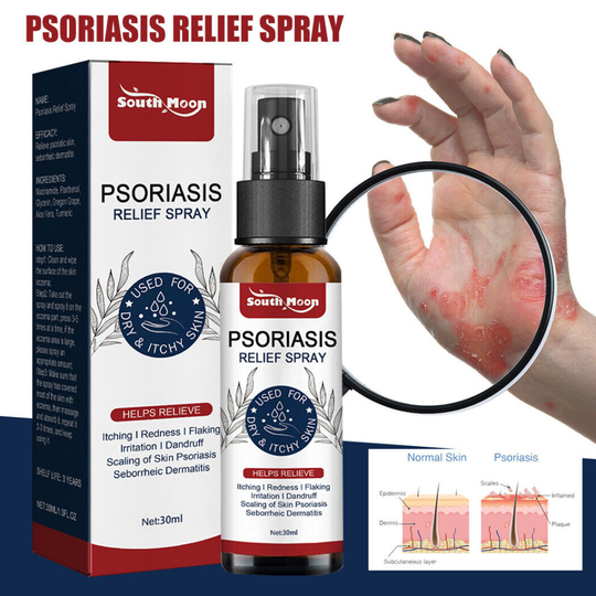 Psoriasis Relief Spray Herbal Essence Itching Treatment Ointment Skin