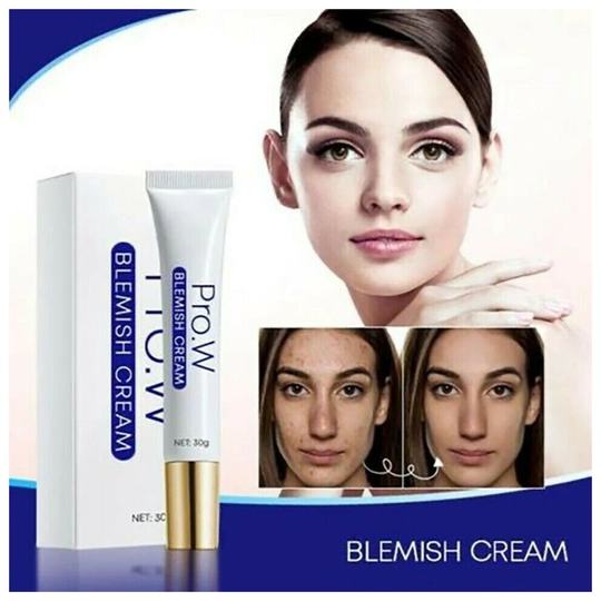Pro.W Blemish Cream Spots Removal Treatment Pimple Ointment Scar Mark