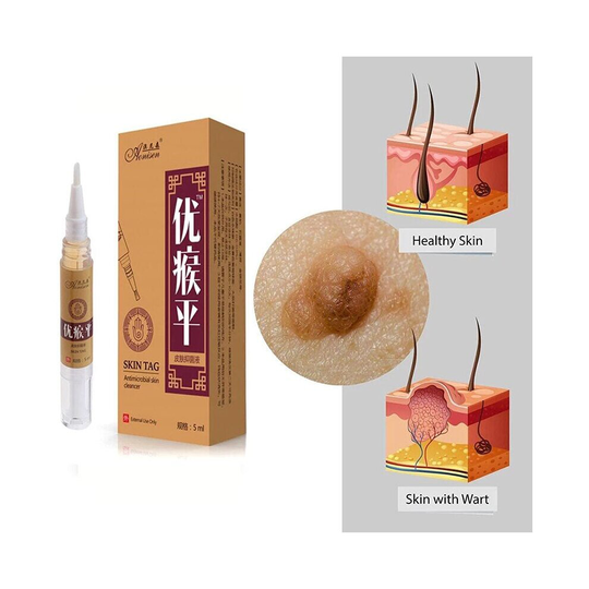 Skin Tag Remover Medical Against Moles Removal Genital Wart Acne Spot Treatment Anti Foot Corn Skin Care Liquid