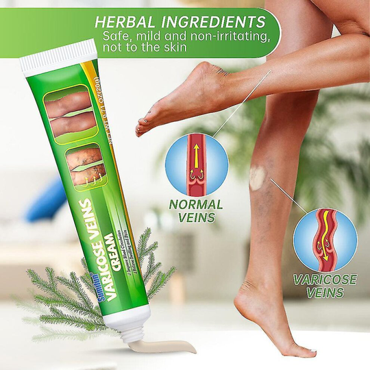 Varicose Vein Cream For Spider Veins Varicose Veins Removal Leg Care Safety Gel