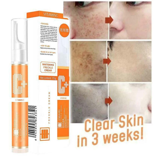 15ml Instant Blemish Removal Gel Face VC Whitening Freckle Serum Brighten Skin