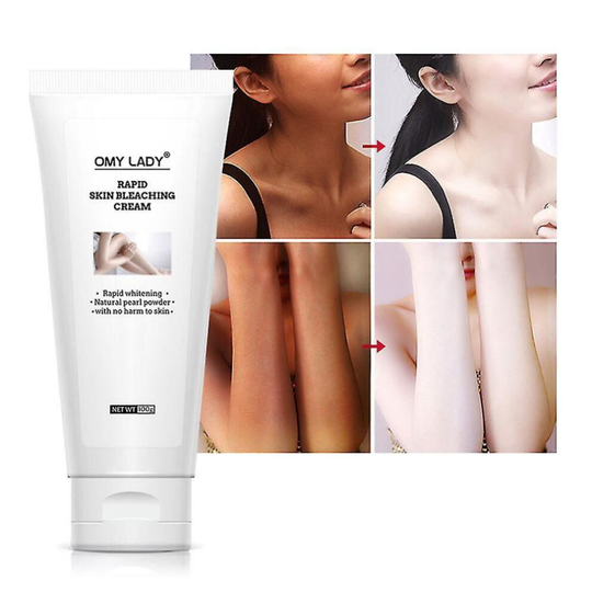 100g Rapid Skin Bleaching Cream Whole Body Whitening Lighten Dark Spots Freckles Melanin Skin Brightening Repairing Lotion