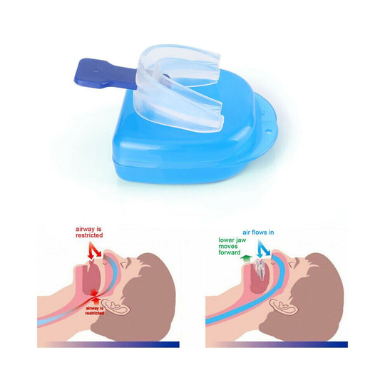 Anti Snore Stop Snoring Tongue Mouth Good Night Sleep Aid Apnea