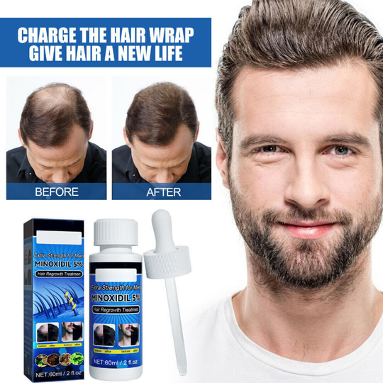 Minoxidil 5% Liquid Extra Strong for Men Beard Hair Regrowth Solution Treatment