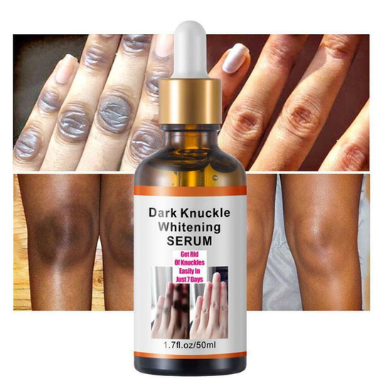 Acanthosis Nigricans Therapy Oil, Dark Spot Corrector Oil
