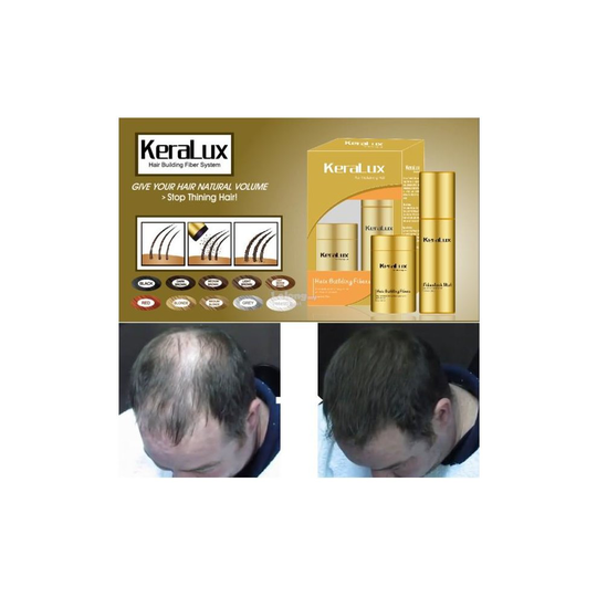 (MEDIUM BLONDE) KERALUX Hair loss building fibers 28grams