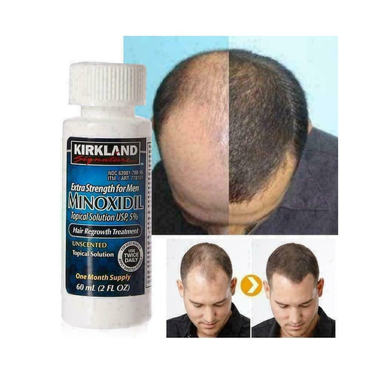 (3 Month Supply) Kirkland Signature 5% Minoxidil Hair Regrowth Treatment For Men - Solution