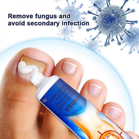 Sumifun 20gnail Treatment Essential Ointment Remove Onychomycosis Fungus Paronychia Promote Nail Growth Anti Infection Nail Care