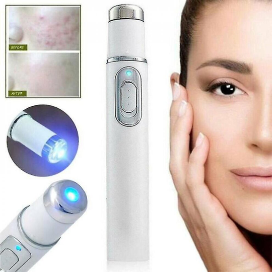 Spider Vein Eraser Blue Light Removal Eraser erapy Wrinkle Acne Laser Pen Scar