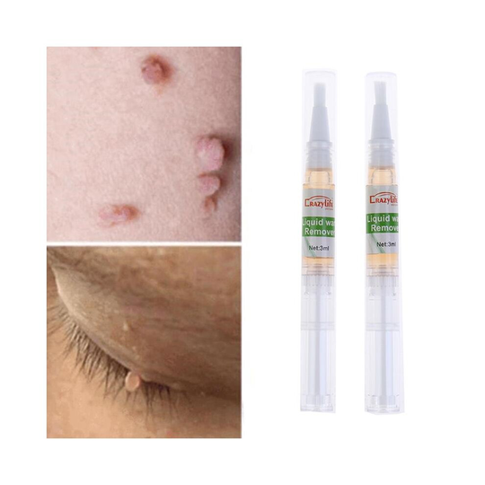 (Default Title) Days Skin Tag Remover Pen