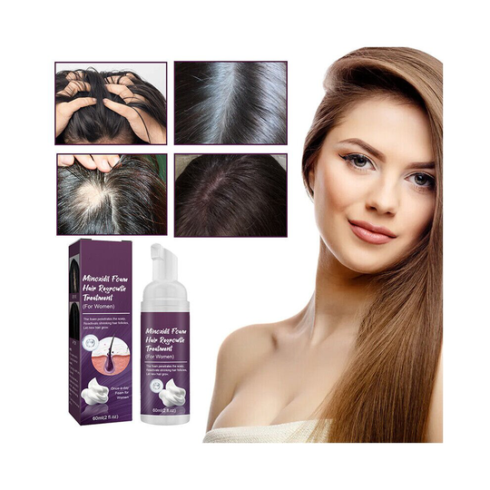 5% Minoxidil Hair Regrowth Foam Treatment for Unisex Hair Growing