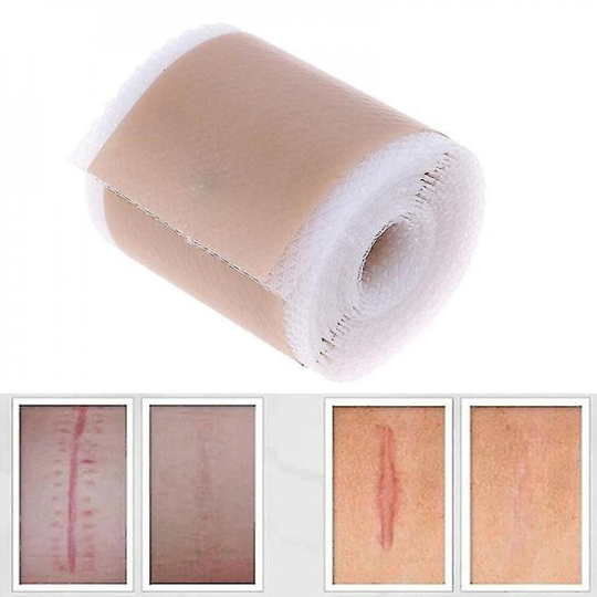 Scar Removal Silicone Gel Tape Patch For Acne Burn Scar Reduce