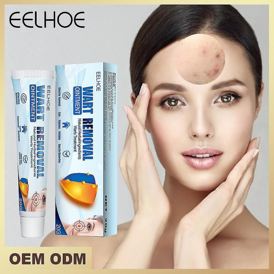 Wart Removal Cream For Hands, Feet, Face, Armpits, Neck, Silky, Flat Wart And Wart Cream 20g