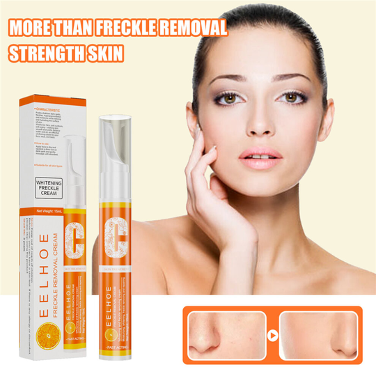 (1 Pc) Vitamin C Blemish Whitening Pen Anti Freckle Spots Melanin Pigment Removal