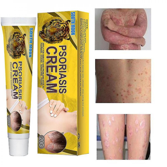 Skin Psoriasis Cream Dermatitis Eczematoid Eczema Ointment Treatment Psoriasis Dermatitis Fungal Anti-itch Skin Care Cream