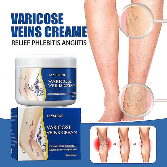 Leg Varicose Vein Repair Cream Professional Earthworm Leg Treatment Ointment