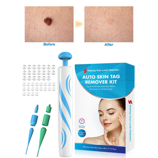 Natural Painless Auto SKIN TAG Removal kit Skintag bands Remover