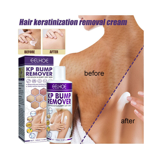 Keratosis Pilaris Repair Cream Natural Ingredients Exfoliating Cream For Folliculitis Skin Treatment 100ml