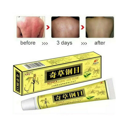 Ointment Advanced Body Psoriasis Herbal Cream 15g