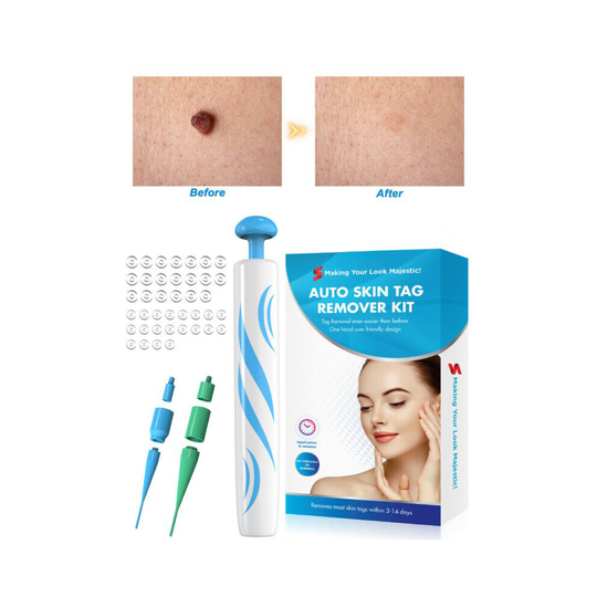 2in1 Painless Auto Skin Tag Mole Wart Removal +40x Rubber Bands +10x Alcohol Pad
